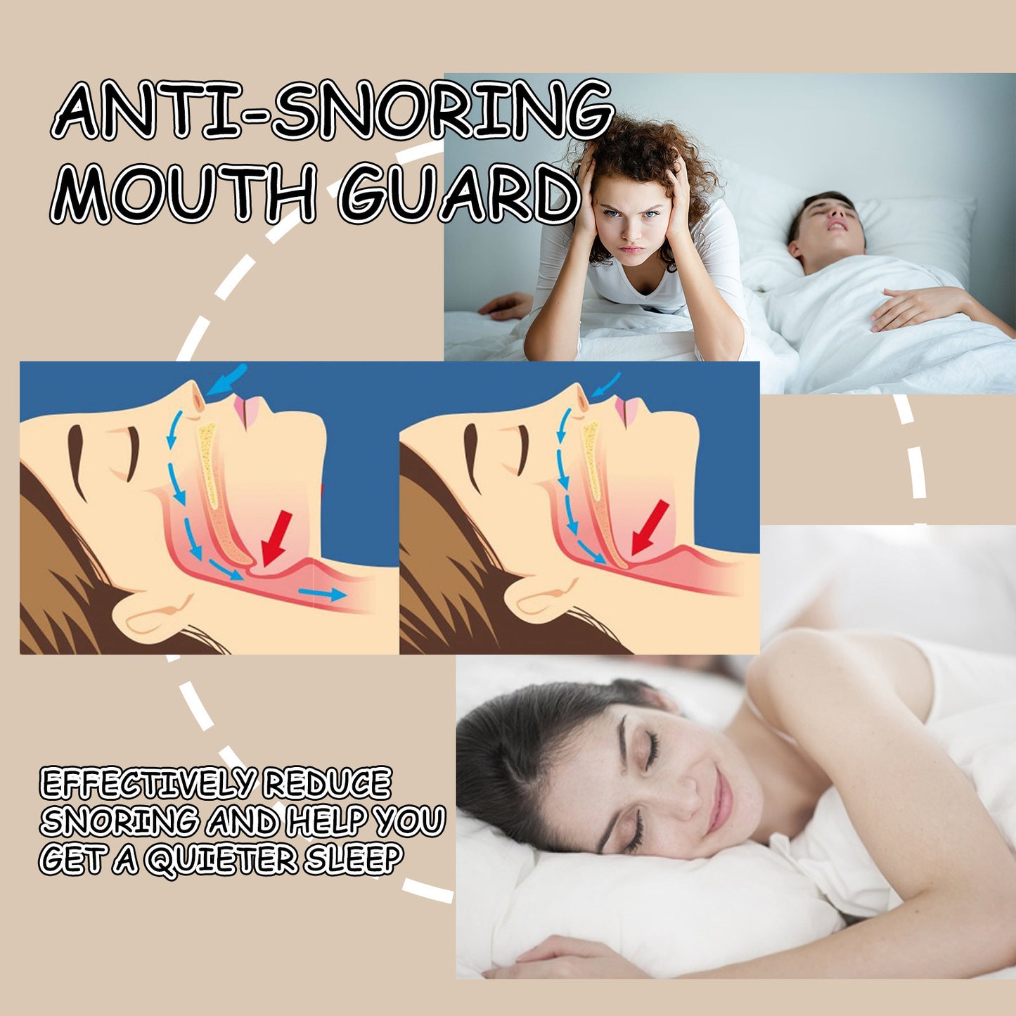 Anti Snoring Tooth Socket Sleep At Night Snoring Molars Care Sleep