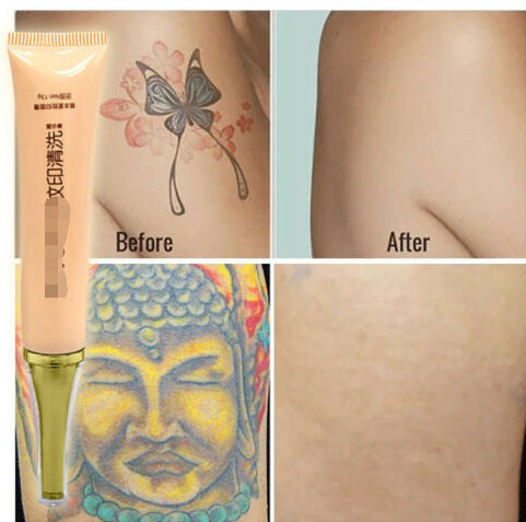 Tattoo Removal Cream - BabynBeauty