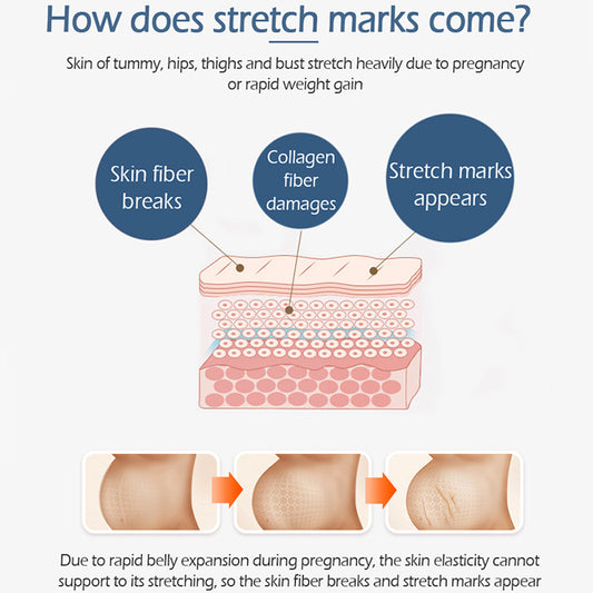 Postpartum repair cream - BabynBeauty