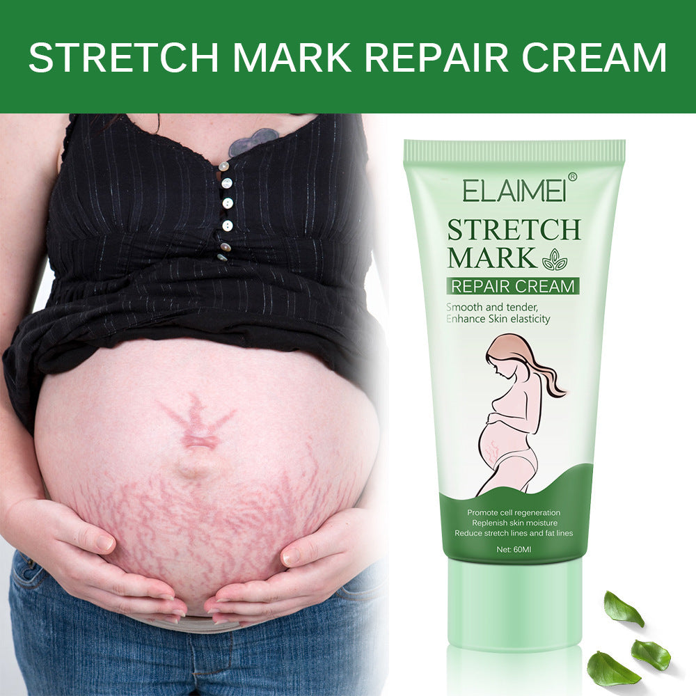 Stretch Mark Repair Cream Smooth Tender Enhance Skin Elastictiy Acne Repair 60ml Anti-Aging Cream Pregnancy Scars - BabynBeauty