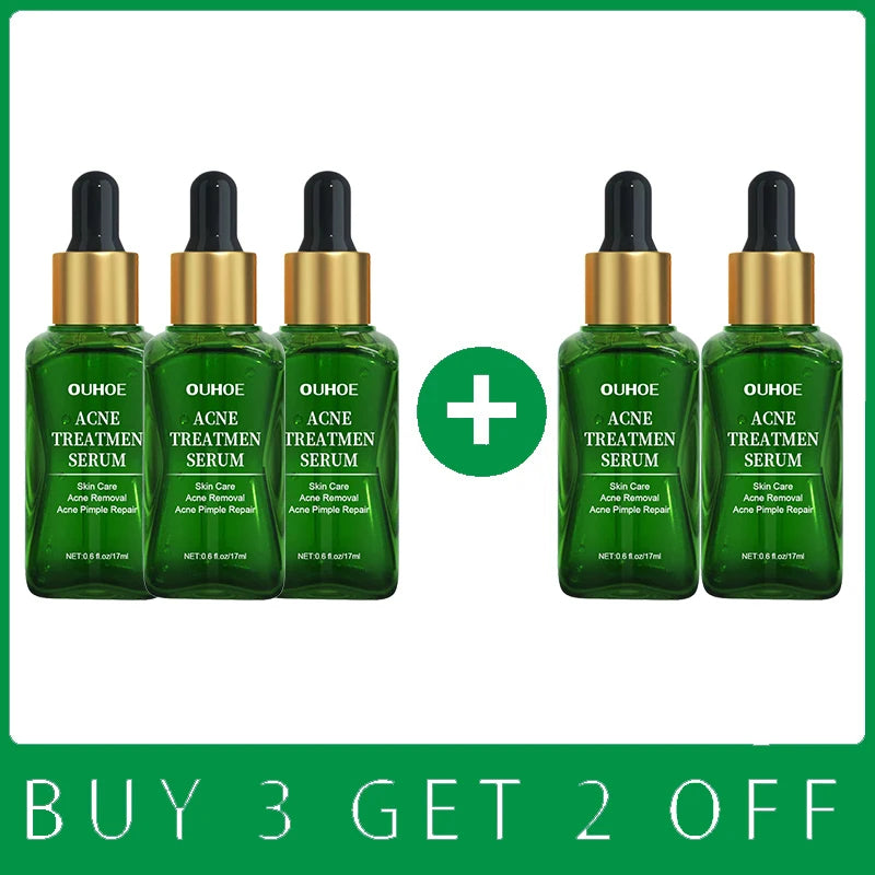 Acne Treatment Facial Serum Pore Shrinking Skin Care Against Face Acne Pimple Spots Remover Cleaning Shrink pores Tea Tree Serum