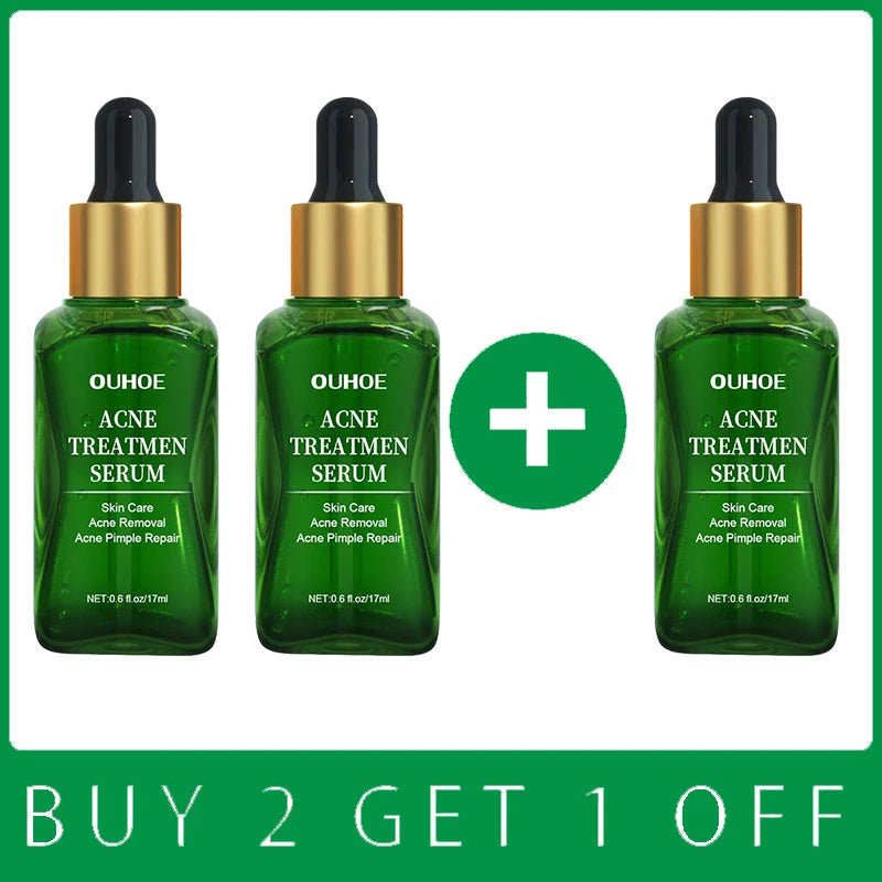 Acne Treatment Facial Serum Pore Shrinking Skin Care Against Face Acne Pimple Spots Remover Cleaning Shrink pores Tea Tree Serum